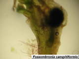 Fossombronia perianth with developing sporophyte and rhizoids