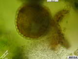 Hornwort antheridia