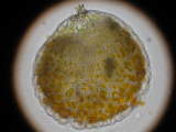 Hornwort antheridium