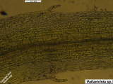 Pallavicinia sp.