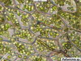 Pallavicinia cells