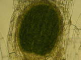 sporophyte
