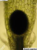 Zoopsis argentea perianth - larger