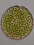 Zoopsis argentea spores