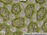 Plagiochila fragmentissima leaf cells