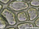 Lepidozia procera cells