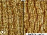 Lepidozia serrulata capsule walls