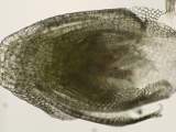 Lepidozia serrulata gynoecium