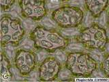 Plagiochila 110908D leaf cells