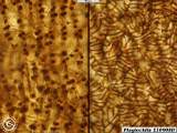 Plagiochila 110723A capsule walls