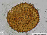 Plagiochila circinalis spore