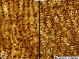 Plagiochila 110723A capsule walls