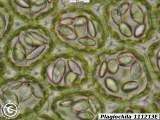 Plagiochila fasciculata cells