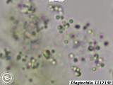 Plagiochila sperm