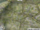 Kurzia 120122D bract cells
