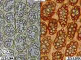 leaf cells