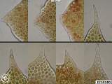 leaf tips