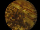 spores