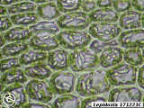 Lepidozia 120811C leaf cells