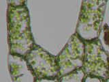 chloroplasts