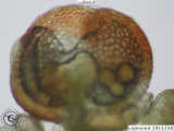 androecium