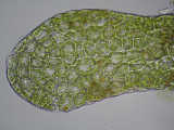 leaf lobule