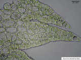 Kurzia dendroides leaf cells