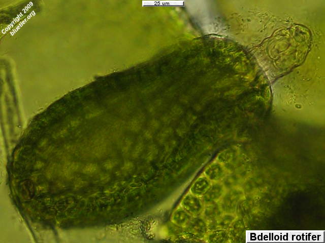 Bdelloid
 rotifer