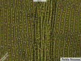 leaf cells