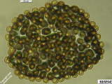 Metatrichia floriformis spores